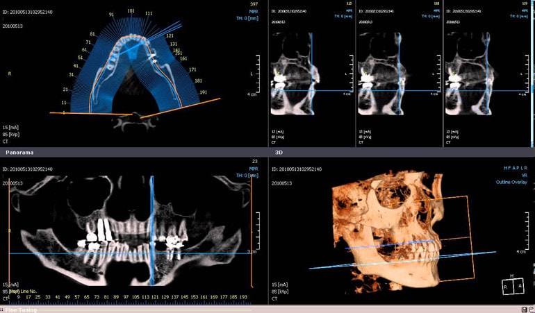 Tomografía Odontológica 3D - Instituto Radiológico Pergamino & Consultorios Médicos Pergamino